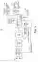 Fig. 04 - Detection of medical electrical lead issues
