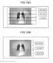 Fig. 16 - Nuclear medicine diagnostic apparatus and control method thereof