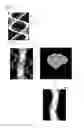 Fig. 06 - Computed tomography apparatus and method of reconstructing a computed tomography image by the computed tomography apparatus