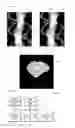 Fig. 07 - Computed tomography apparatus and method of reconstructing a computed tomography image by the computed tomography apparatus
