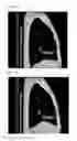 Fig. 07 - Lung Phantom System For 4D-CT