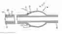 Fig. 01 - Minimally invasive methods and apparatus