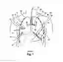 Fig. 02 - Minimally invasive methods and apparatus