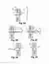 Fig. 04 - Minimally invasive methods and apparatus