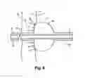 Fig. 06 - Minimally invasive methods and apparatus