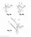 Fig. 09 - Minimally invasive methods and apparatus