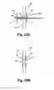 Fig. 28 - Minimally invasive methods and apparatus