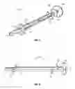Fig. 04 - Medical apparatus for sampling cervical tissue