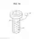 Fig. 16 - NIR/red light for lateral neuroprotection
