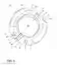 Fig. 02 - Eyelid speculum