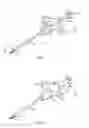Fig. 02 - SUTURE CUTTER