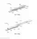 Fig. 16 - METHODS AND APPARATUS FOR INHIBITING SCAR FORMATION