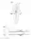 Fig. 02 - Implantable tissue connector