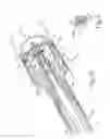 Fig. 05 - Pivoting anvil for surgical circular stapler