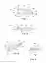 Fig. 02 - Vascular and intestinal occlusion