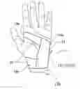 Fig. 01 - Method of transradial catheterization, device for ulnar artery compression, and method of use