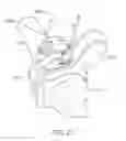 Fig. 22 - System for positioning a cutting guide in knee surgery