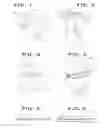 Fig. 02 - Methods and devices for attaching or reattaching soft tissue to bone
