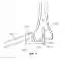 Fig. 07 - ROBOTIC GUIDE ASSEMBLY FOR USE IN COMPUTER-AIDED SURGERY