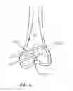 Fig. 08 - ROBOTIC GUIDE ASSEMBLY FOR USE IN COMPUTER-AIDED SURGERY