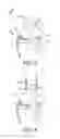 Fig. 03 - Device and method for installing femoral prosthetic knee joint