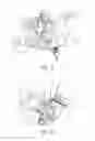 Fig. 16 - Device and method for installing femoral prosthetic knee joint