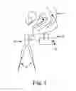 Fig. 02 - TOOLS AND METHODS FOR TREATMENT OF PELVIC CONDITIONS