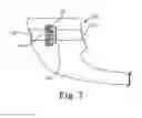 Fig. 06 - TOOLS AND METHODS FOR TREATMENT OF PELVIC CONDITIONS
