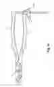Fig. 03 - Orthopedic trigger apparatus