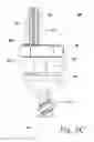 Fig. 08 - Implants for securing spinal fixation elements