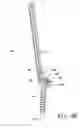 Fig. 10 - Implants for securing spinal fixation elements