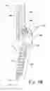 Fig. 16 - Implants for securing spinal fixation elements