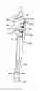 Fig. 01 - Fracture fixation device having clip for stabilizing intramedullary nail