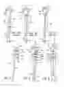 Fig. 03 - Fracture fixation device having clip for stabilizing intramedullary nail