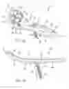 Fig. 02 - Polyaxial locking mechanism