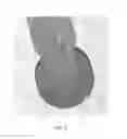 Fig. 06 - Split hexalobe driver device for use in surgical procedures