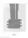 Fig. 08 - Split hexalobe driver device for use in surgical procedures