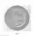 Fig. 09 - Split hexalobe driver device for use in surgical procedures