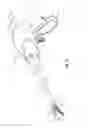 Fig. 02 - Apparatus for performing an electrosurgical procedure
