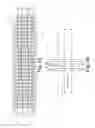 Fig. 03 - Precision electrode movement control for renal nerve ablation