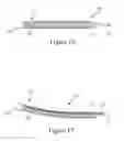 Fig. 14 - Precision electrode movement control for renal nerve ablation
