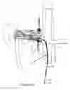 Fig. 15 - Precision electrode movement control for renal nerve ablation