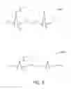 Fig. 07 - Ablation systems and methods using heat shunt networks