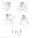 Fig. 35 - Ablation catheters