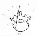 Fig. 10 - System and methods for intraoperative guidance feedback