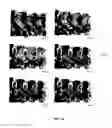 Fig. 22 - System and methods for intraoperative guidance feedback