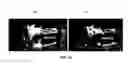 Fig. 28 - System and methods for intraoperative guidance feedback