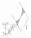 Fig. 03 - Robotic devices and systems for performing single incision procedures and natural orifice translumenal endoscopic surgical procedures, and methods of configuring robotic devices and systems