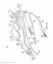 Fig. 07 - Robotic devices and systems for performing single incision procedures and natural orifice translumenal endoscopic surgical procedures, and methods of configuring robotic devices and systems