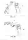 Fig. 06 - Depth limiter for suturing devices and methods thereof